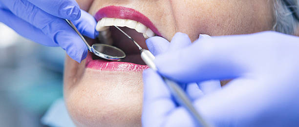 Best Emergency Treatment for Dental Infections or Abscesses in Stroudsburg, PA